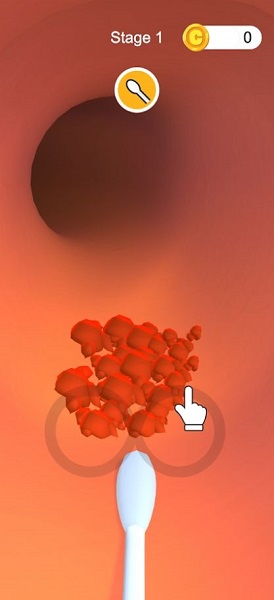 耳垢诊所手游下载