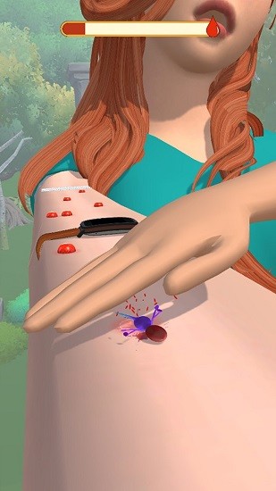 蚊子我最美 蚊子我最美下载